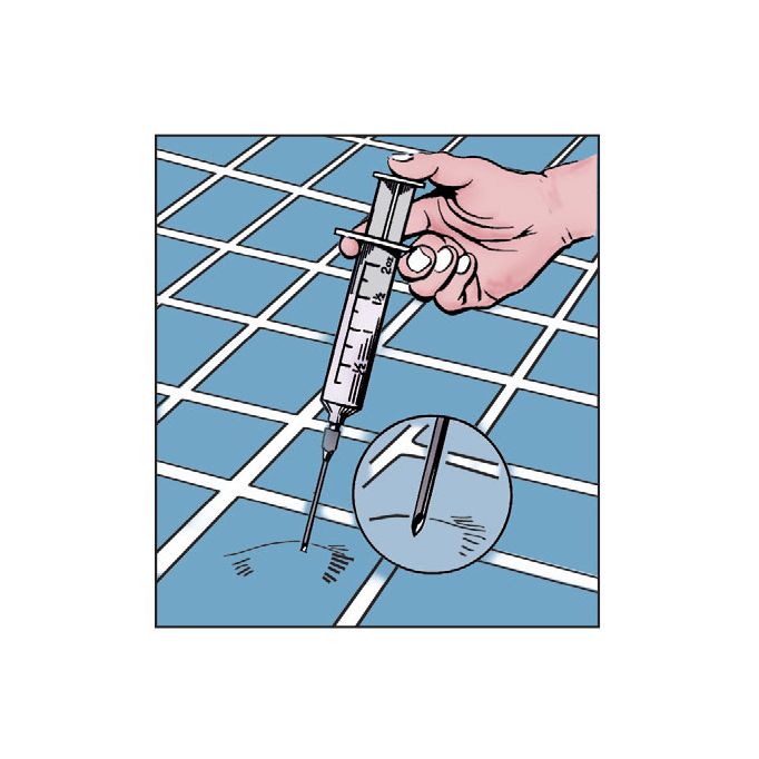 Crain 143 Adhesive Syringe